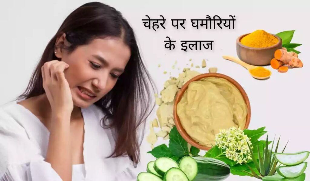 गर्मी के मौसम में चेहरे पर घमौरी निकलना आम समस्या है। इससे जलन, खुजली और दाने जैसी परेशानी होती है। जानिए चेहरे पर घमौरी का इलाज घरेलू नुस्खों और आसान उपायों से, जिससे आप तुरंत राहत पा सकते हैं। आइए पढ़ें चेहरे की घमौरी का सही इलाज और बचाव के तरीके।