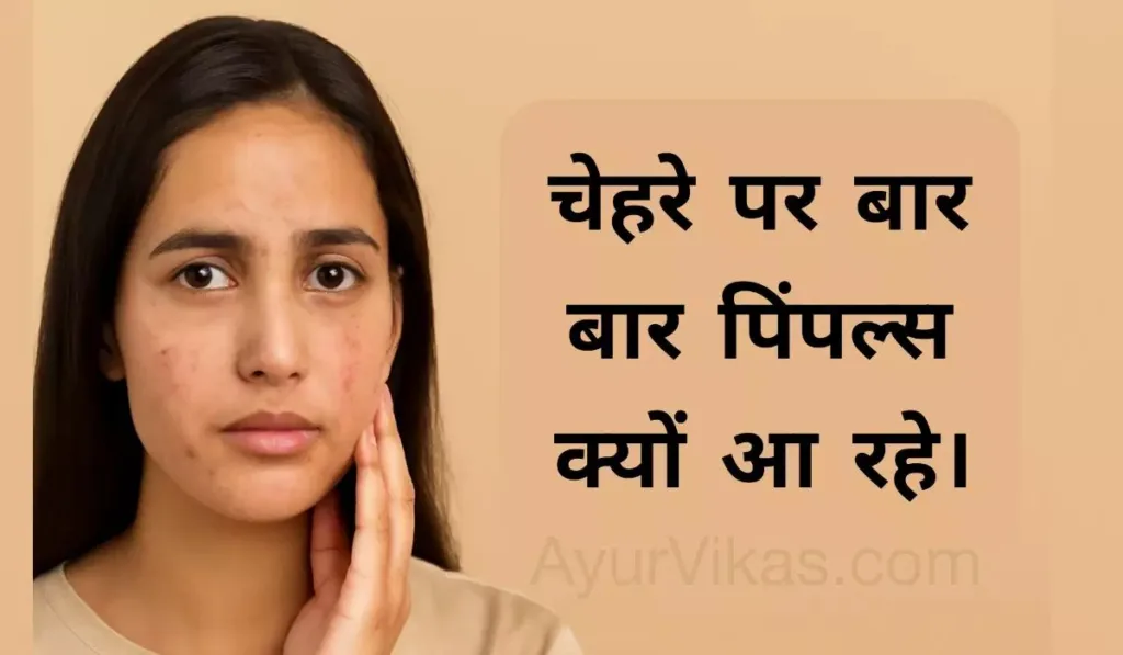 युवा दक्षिण एशियाई महिला का चित्र, जिसमें उसके चेहरे पर पिंपल्स नजर आ रहे हैं। महिला के चेहरे पर चिंता की भावनाएँ हैं, और चित्र के पास हिंदी में "चेहरे पर बार-बार पिंपल्स क्यों होते हैं?" लिखा हुआ है, जो पिंपल्स के कारणों और उनके इलाज के बारे में जानकारी देता है।