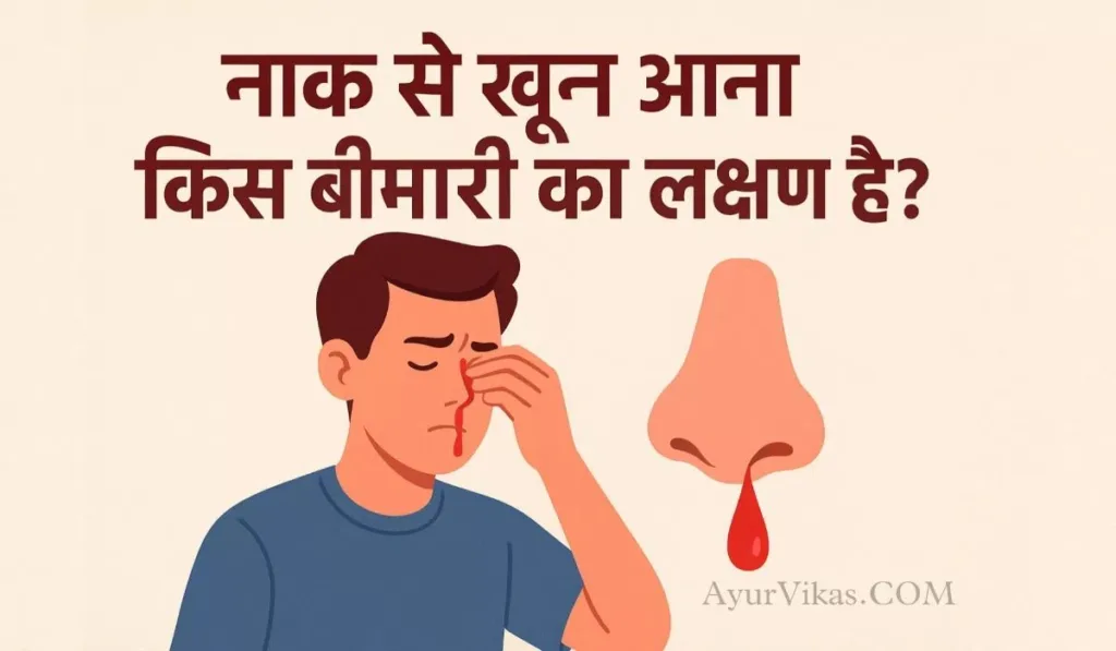 एक डिजिटल इलस्ट्रेशन जिसमें एक युवा व्यक्ति अपनी नाक पकड़कर खून बहने से परेशान दिखाई दे रहा है। उसके बगल में नाक का बड़ा ग्राफिक दिखाया गया है, जिससे लाल रंग की रक्त की बूंद टपक रही है। ऊपर हिंदी में शीर्षक लिखा है – “नाक से खून आना किस बीमारी का लक्षण है?” यह छवि नकसीर, नाक से रक्तस्राव, हाई ब्लड प्रेशर, गर्मी, एलर्जी और स्वास्थ्य संबंधी समस्याओं को दर्शाने के लिए उपयोग की गई है।